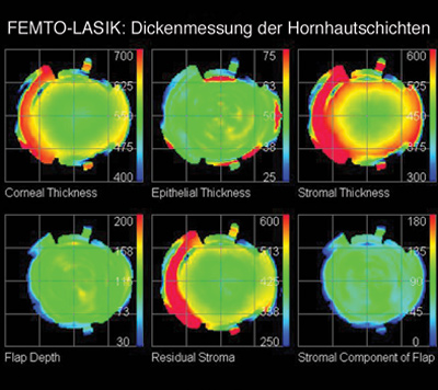 Femtosekundenlaser